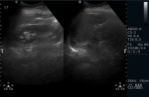 Ultraschalluntersuchung der inneren Organe des Menschen — Stockfoto