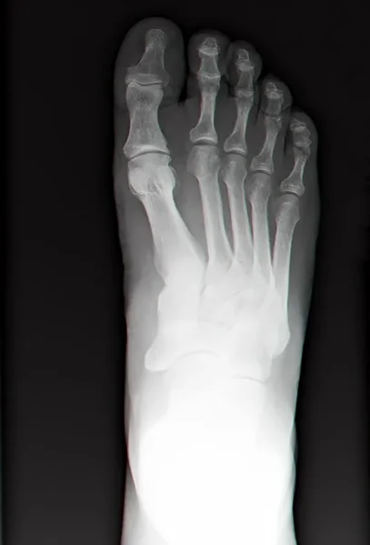 Human leg bone X-rays — Stock Photo, Image