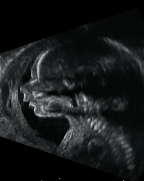 超声胎儿 — 图库照片