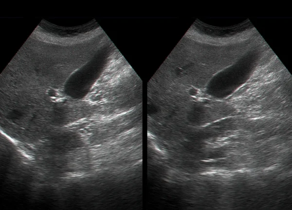 Insan iç organlarını ultrason muayenesi — Stok fotoğraf