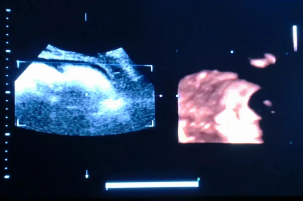 Ultrason fetusu — Stok fotoğraf