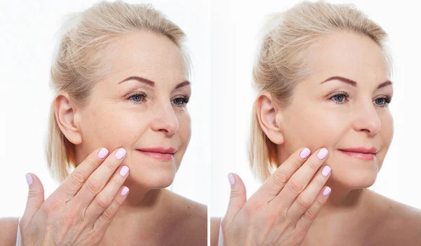 Middle Age Close Woman Face Cosmetic Procedures Skin Care Wrinkled — Stock Photo, Image