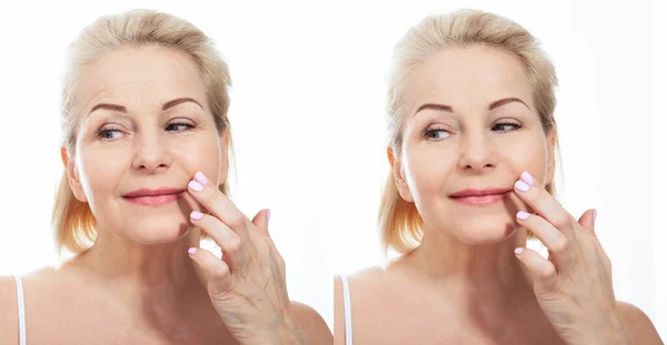 中年妇女在做完整容手术前面面相觑 皱纹脸的皮肤护理 抗衰老前的面部整容治疗 面部皮肤护理和等高线 — 图库照片
