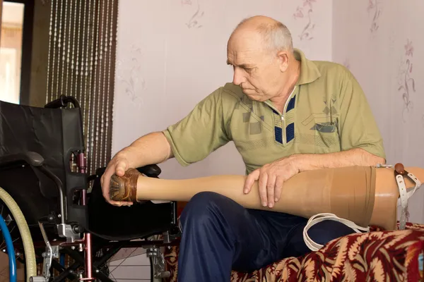 Hombre mayor mirando su pierna artificial — Foto de Stock