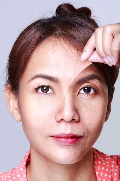 Ασιατική γυναίκα με πρόβλημα και καθαρό δέρμα — Φωτογραφία Αρχείου