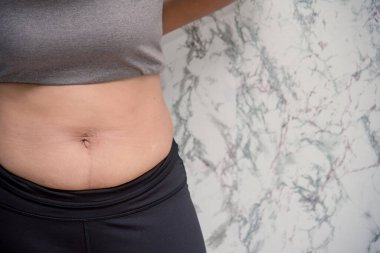 Beyaz arka planda karnına dokunan şişman bir kadın.