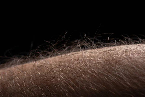 Human skin with hair on black background. Goose bumps.