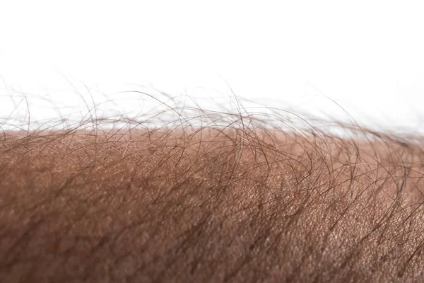 Human skin with hair on white background. Goose bumps.