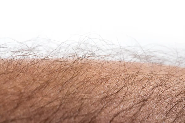 Human skin with hair on white background. Goose bumps.