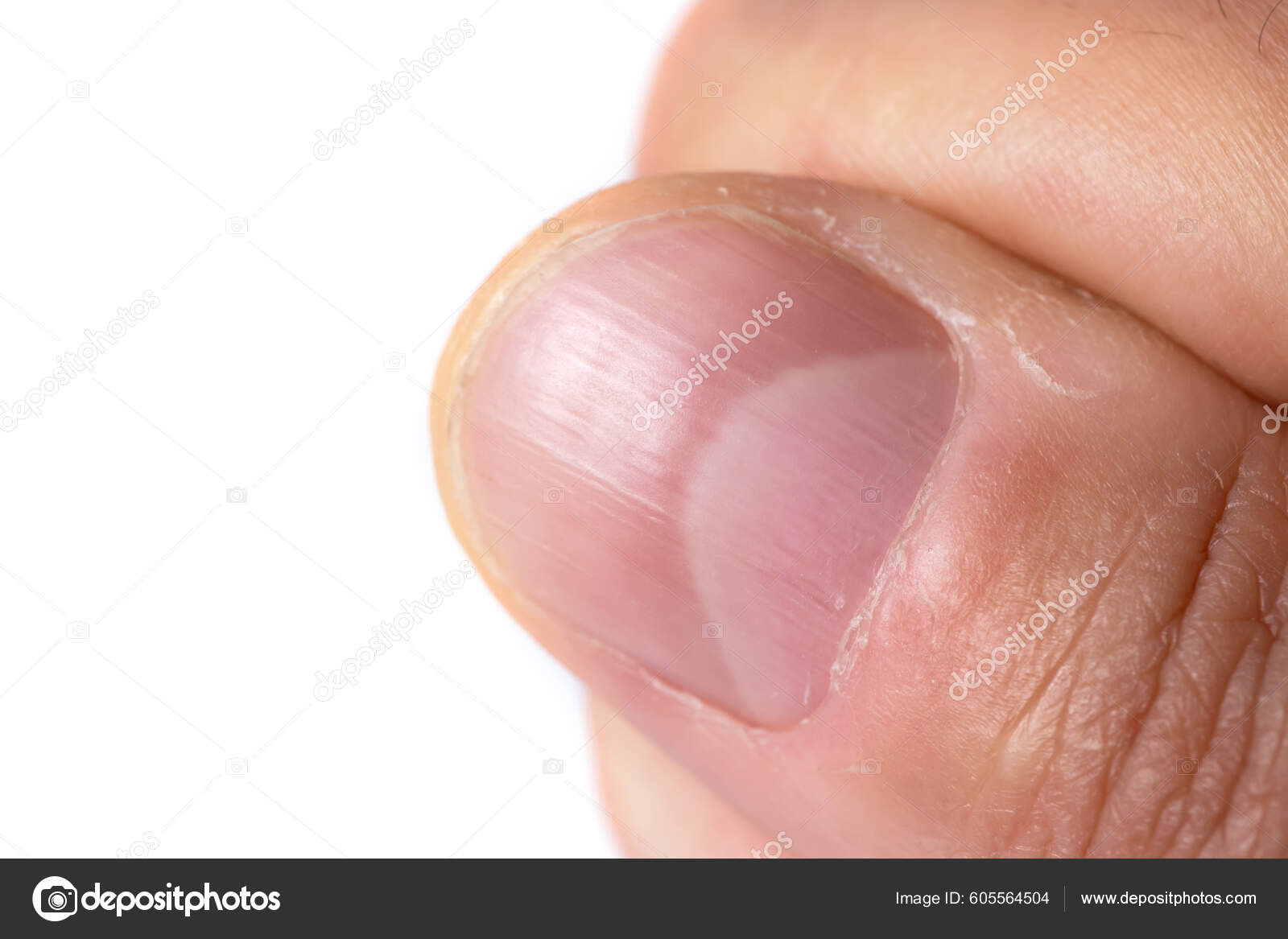 Ridges for nails Stock Photos, Royalty Free Ridges for nails Images | Depositphotos Ridges for nails Stock Photos, Royalty Free Ridges for nails Images | Depositphotos