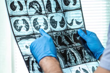 Doktor hastanın MRI tarama dikkatle inceliyor