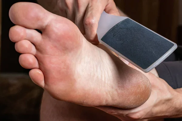 Close up of man\'s heels holding a heel brush. Natural gray pumice stone for feet. care for dry heels and feet. tools for feet care