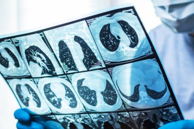 Doktor hastanın MRI tarama dikkatle inceliyor