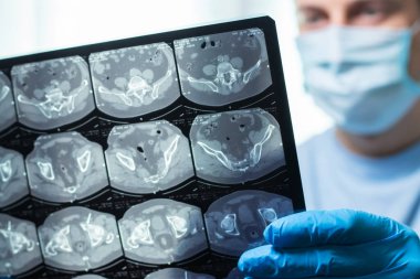 Maskeli adam hastanede beyin MR 'ını inceliyor..