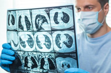 Maskeli adam hastanede beyin MR 'ını inceliyor..