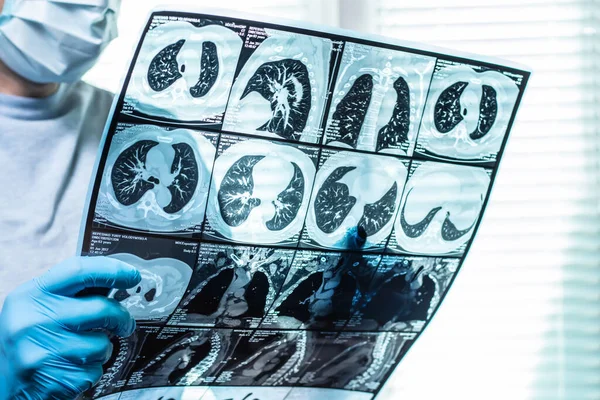 Doktor hastanede kafa MRI görüntüsünü inceliyor..