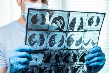 Doktor hastanın MRI tarama dikkatle inceliyor