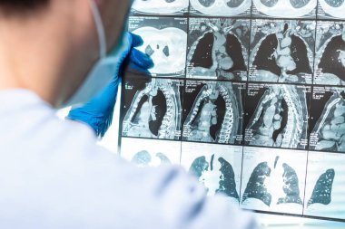 Doktor hastanın MRI tarama dikkatle inceliyor