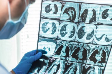 Doktor hastanede MRI görüntüsünü inceliyor..