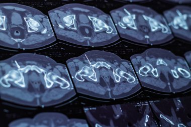 Vücut tomografisi arkaplanını kapat.