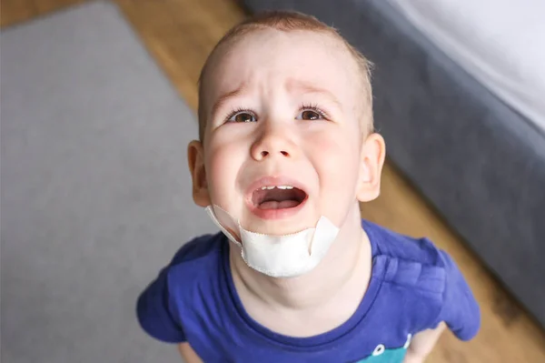 baby chin in bandage. Pain, injuries of children. Broken chin