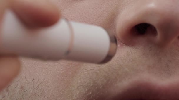 Homme traitant bouton douloureux rouge sur son visage avec un stylo cosmétique laser, macro — Video