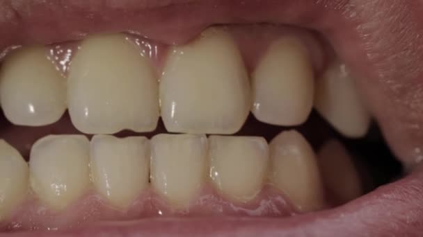 Крупным планом человеческие зубы и челюсть. Концепция стоматологической помощи в современной стоматологии, макрохирургия — стоковое видео