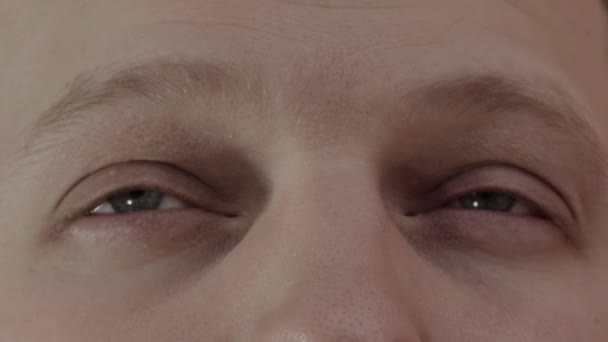 Sleepy eyes in a man, fatigue. Human eyes before sleep, macro — Stock Video