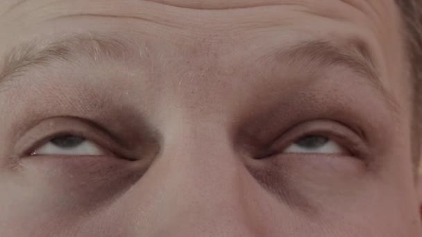 Un hombre se frota los ojos cansados con las manos, una mota en el ojo, macro — Vídeo de stock