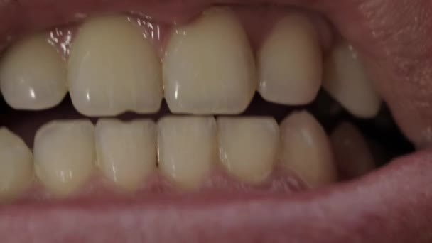 Opening and closing the jaw with teeth. Dental jaw malocclusion concept, macro. Jaw bite — Stock Video