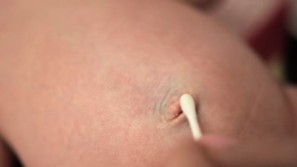 Modern behandlar nyfödda navel med antibakteriell bomull knopp. Sköterskan rengör babys navel från koagulerat blod och smuts. Umbilikus av spädbarn. Närbild. Vårdhygien för vit 1 månad diande. Pediatriker — Stockvideo