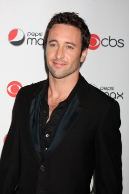 Alex O'Loughlin