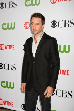 Alex O'Loughlin