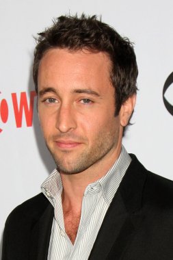 Alex O'Loughlin