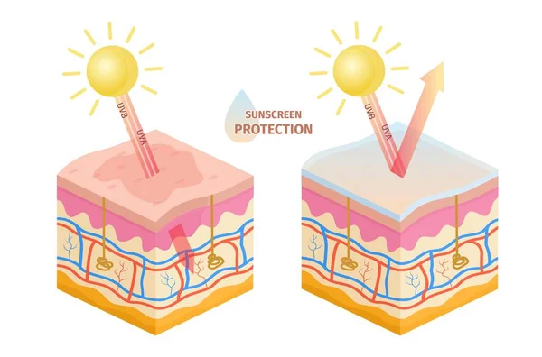 Huid Stralen Bescherming Voor Zonnebrandcrème Sun Uva Uvb Epidermis Schade — Stockvector