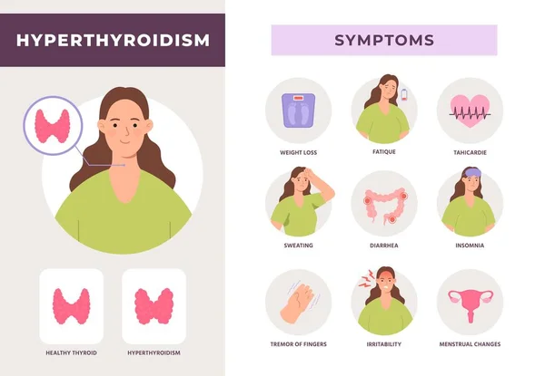 Gejala hipertiroidisme infografis, penyakit kelenjar tiroid yang terlalu aktif. Info kesehatan sistem endokrin dengan poster vektor karakter wanita datar - Stok Vektor