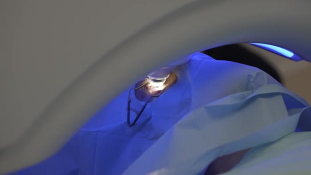 Correction des yeux au laser par la méthode SMILE. Le laser descend à l'œil du patient. — Video