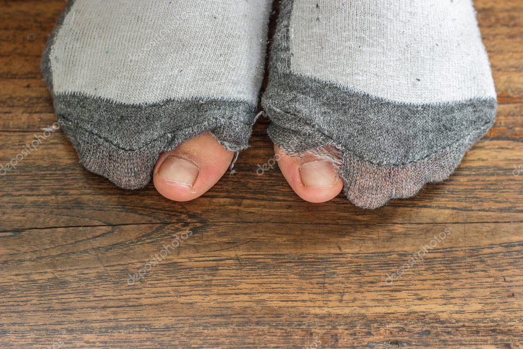 Calcetines gastados con un agujero y dedos de los pies