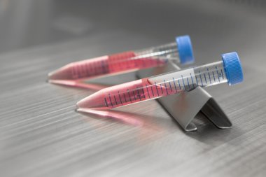 test tüpleri ile biyoloji laboratuarında kan örneği
