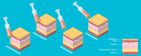 Illustration conceptuelle 3D vecteur plat isométrique des types d'injection — Image vectorielle