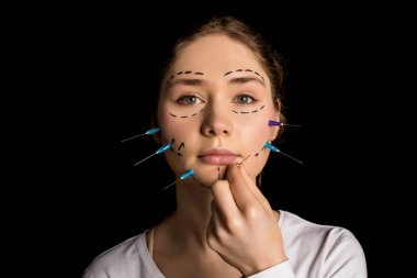 Estetik ameliyat konsepti. Siyah arka planda çizgileri ve şırıngaları olan güzel sarışın kadın portresi. Plastik Cerrahi Operasyonundan Önce Güzel Kadın.