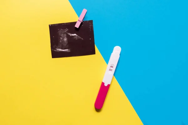 Pozitivní Těhotenský Test Ultrazvukovým Obrazem Modrém Žlutém Pozadí — Stock fotografie