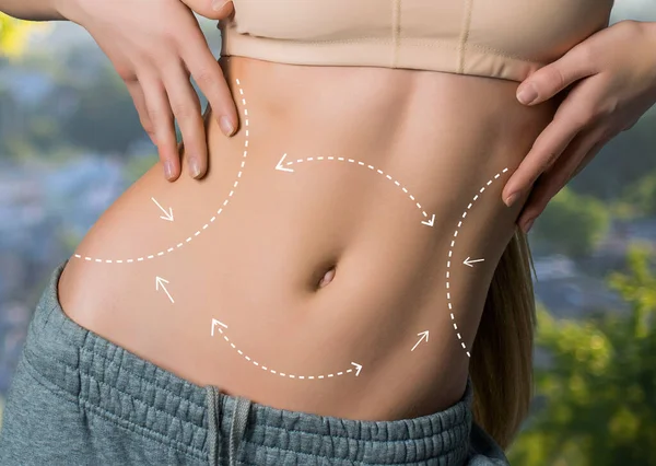 The body of a woman of perfect shape with the image of lines for incisions. concept of plastic surgery. nature background