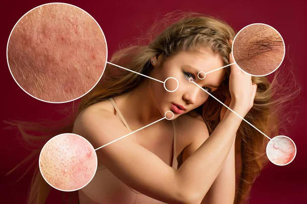 Female Face Close Show Skin Problems Dry Skin Acne Wrinkles — Fotografia de Stock