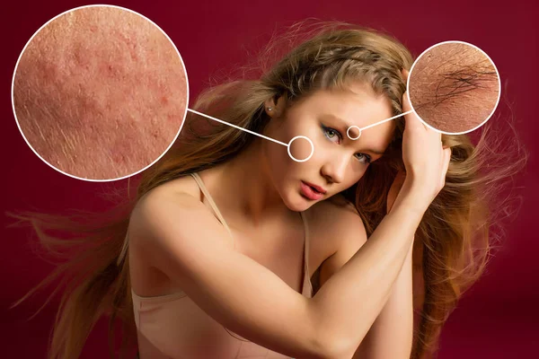 Face Feminina Perto Mostrar Problemas Pele Pele Seca Acne Rugas — Fotografia de Stock