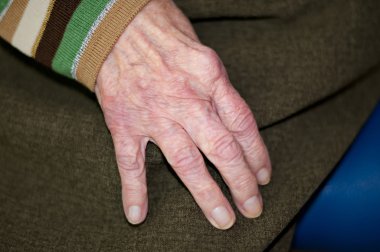 yaşlı kişinin elleri