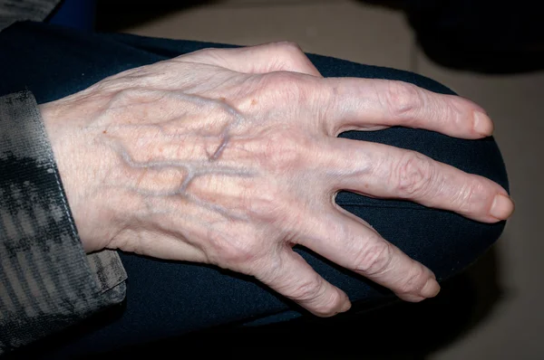 Mãos de idosos — Fotografia de Stock