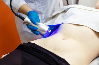 Güzellik salonundaki bir figürün donanım düzeltme prosedürü. Kriyoterapi.