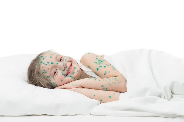 Menina doente na cama branca — Fotografia de Stock