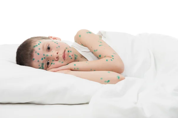 Menino doente na cama branca — Fotografia de Stock